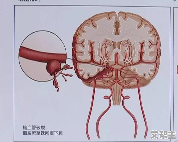 破苞XXXX出血69Av，震撼全网的惊人事件引发热议，网友纷纷围观讨论！